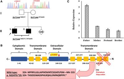 Novel compound heterozygous variants (c.971delA/c.542C > T) in SLC1A4 causes spastic tetraplegia, thin corpus callosum, and progressive microcephaly: a case report and mutational analysis